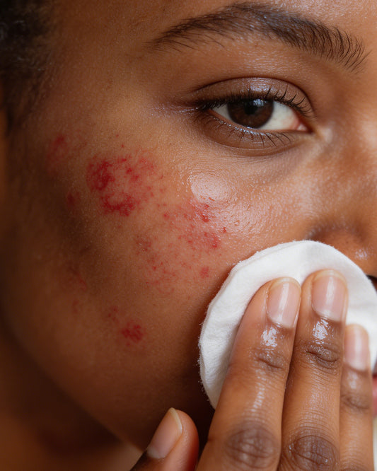 Camellia Repairing Spray 120ml skincare product photo 3