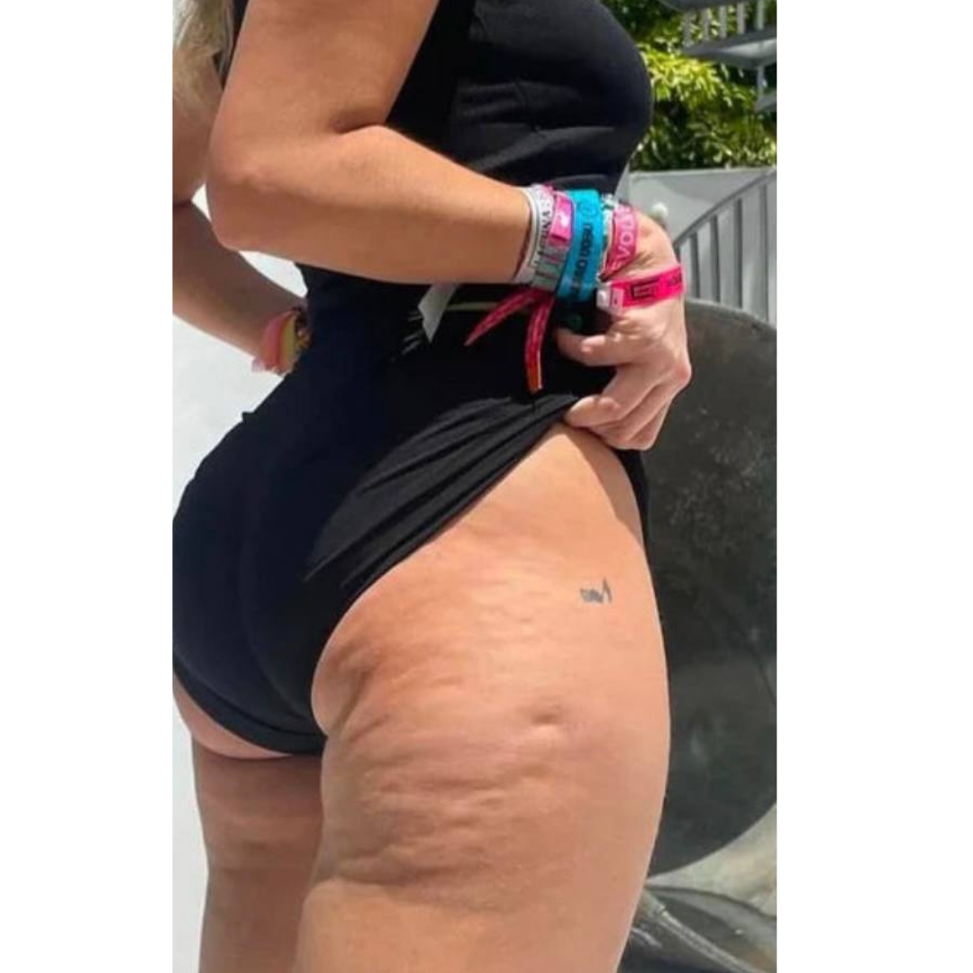 Before skin texture